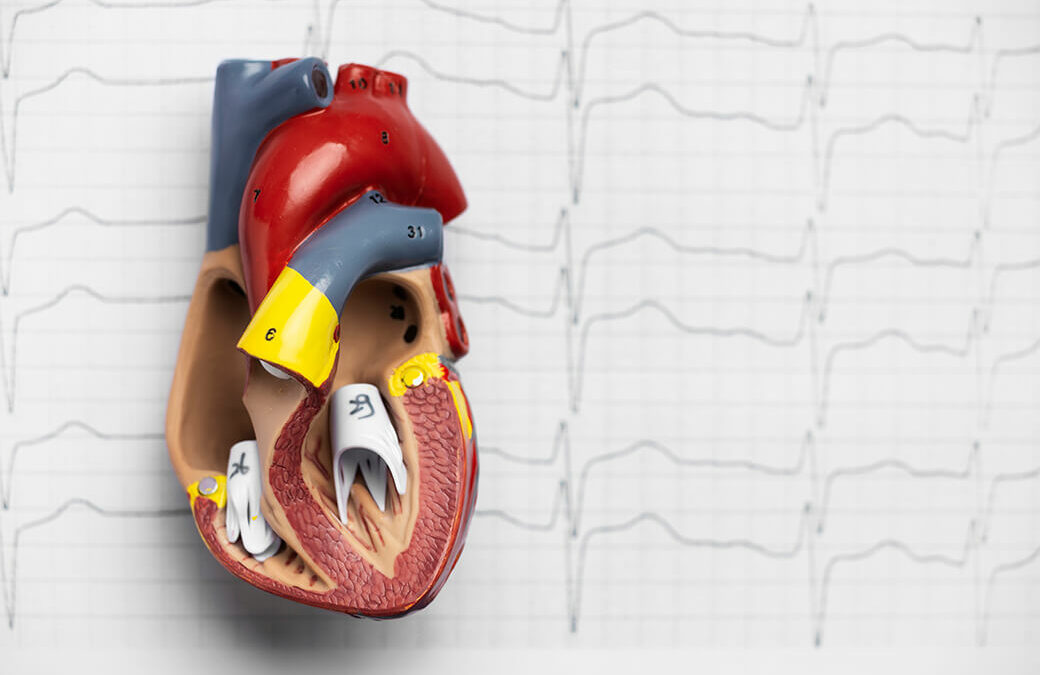 Atriyal Fibrilasyon Belirtileri Arasında Neler Yer Almaktadır? - Prof. Dr. Sedat Köse | Ablasyon, Kalp Çarpıntısı, Ritim Bozukluğu